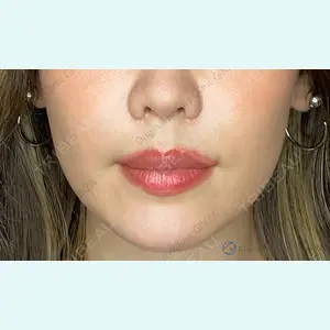 Original Beauty Clinic GINZA 佐藤玲史医師の症例