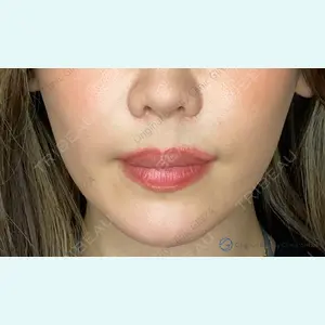 Original Beauty Clinic GINZA 佐藤玲史医師の症例
