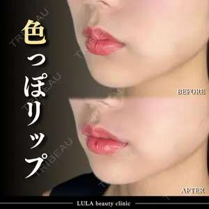 ルラ美容クリニック 千葉院 下川 洋輝医師の症例