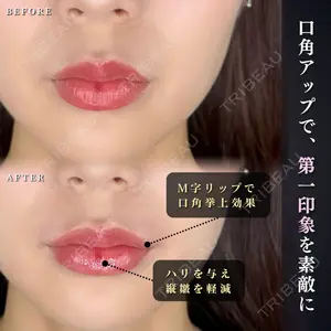 ルラ美容クリニック 千葉院 下川 洋輝医師の症例