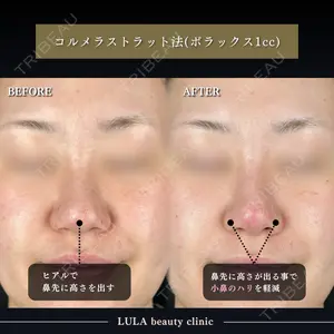 ルラ美容クリニック 千葉院 下川 洋輝医師の症例