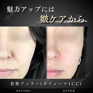 ルラ美容クリニック 千葉院 下川 洋輝医師の症例
