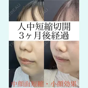 ルラ美容クリニック 岡山院の症例