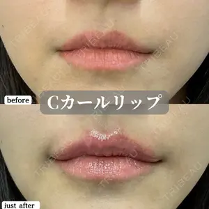 症例