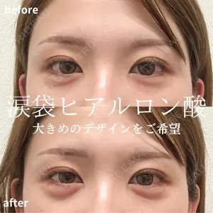 症例