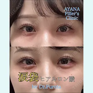 症例