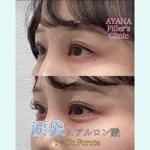 AYANAフィラーズクリニック 渋谷院 古田 晃医師の症例