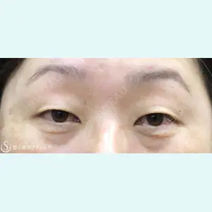症例