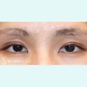 聖心美容クリニック 六本木院 菱田 健作医師の症例