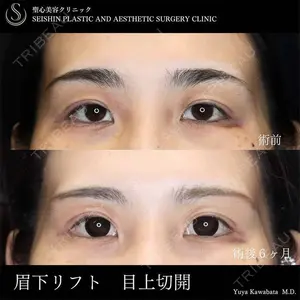 聖心美容クリニック 六本木院 川端 優也医師の症例
