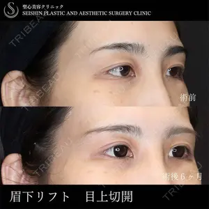 聖心美容クリニック 六本木院 川端 優也医師の症例