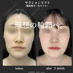 症例