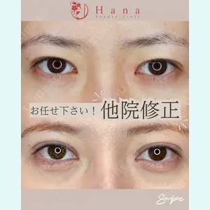 症例