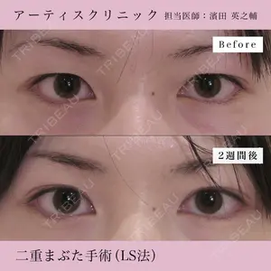 症例