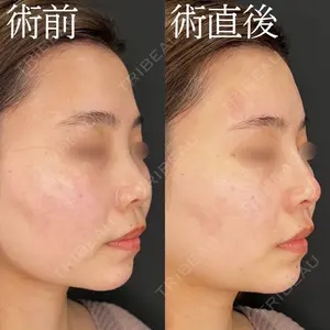 HAAB×DREAM BEAUTY CLINIC 大阪梅田院 柏木 太雅医師の症例