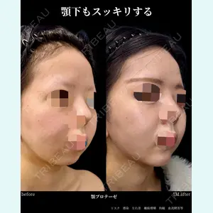 グローバルビューティークリニック 大阪院の症例