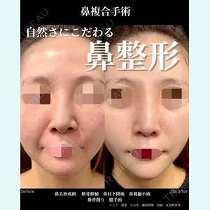 グローバルビューティークリニック 大阪院の症例