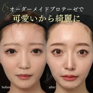 症例