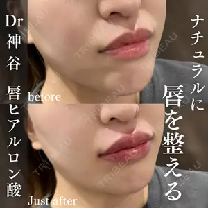 EMMO FACE CLINIC 大阪梅田院 神谷 一成医師の症例