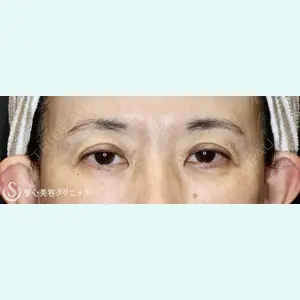 聖心美容クリニック 六本木院 星野 善允医師の症例