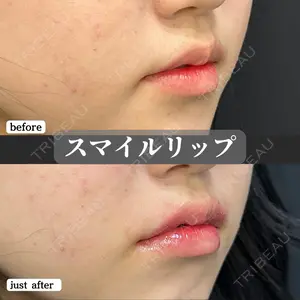 症例