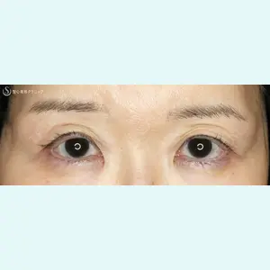 聖心美容クリニック 札幌院 前多 一彦医師の症例