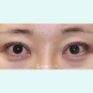 聖心美容クリニック 六本木院 菱田 健作医師の症例