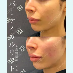 EMMO FACE CLINIC 大宮院 廣松 直樹医師の症例