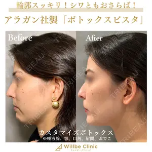 ウィルビークリニック 銀座院の症例