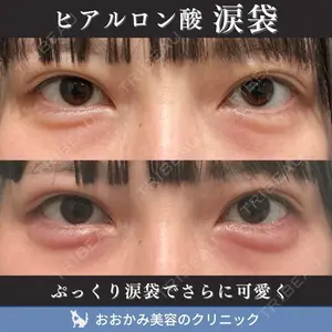 症例