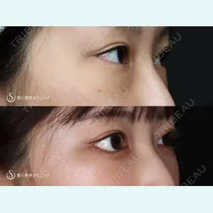 聖心美容クリニック 大阪院 寺町 英明医師の症例