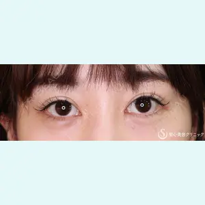 症例