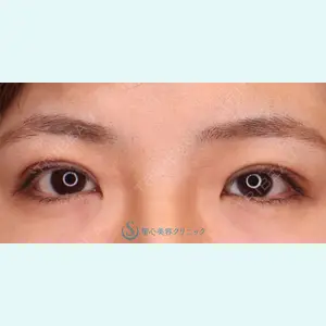 聖心美容クリニック 六本木院 菱田 健作医師の症例