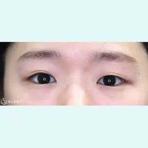 症例