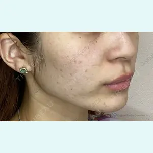 Original Beauty Clinic GINZA 佐藤玲史医師の症例