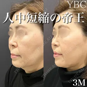 YBC横浜美容外科 大宮院 磯村 亮輔医師の症例