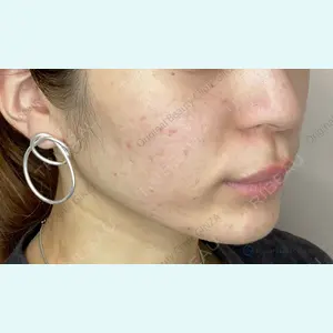 Original Beauty Clinic GINZA 佐藤玲史医師の症例