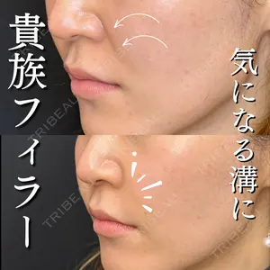 ルラ美容クリニック 大宮院 右京 大季医師の症例