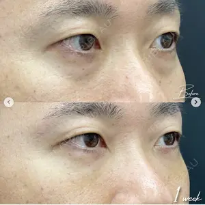 湘南美容クリニック 浜松院の症例
