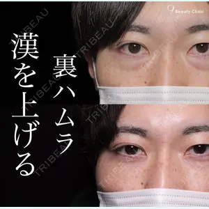 症例