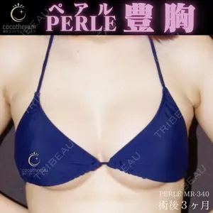 症例