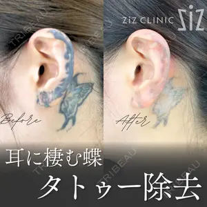 ziz CLINIC 村岡 史子医師の症例