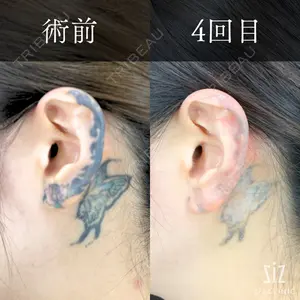ziz CLINIC 村岡 史子医師の症例