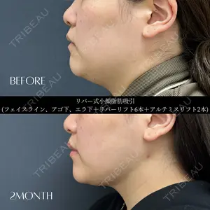 RIVER CLINIC（リバークリニック）大阪院の症例