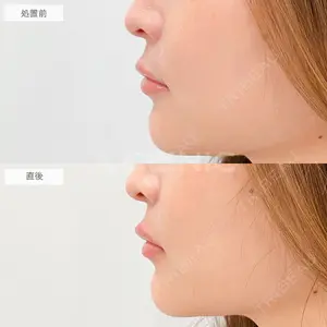 A CLINIC（エークリニック） 大阪院 田窪 賢志郎医師の症例