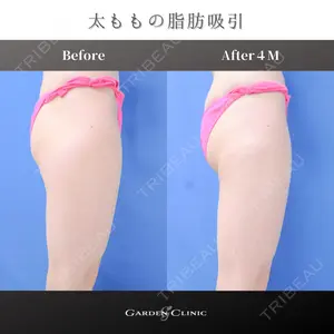 ガーデンクリニック 池袋院の症例