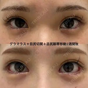 エターナル美容クリニックの症例