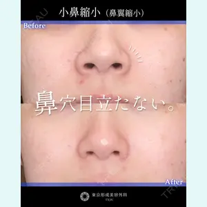 東京形成美容外科 船橋院 山崎 修吾医師の症例