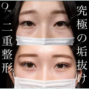 症例