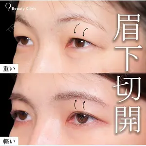 症例